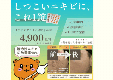 Mona青山クリニックの口コミから評判を徹底調査!料金や効果は？